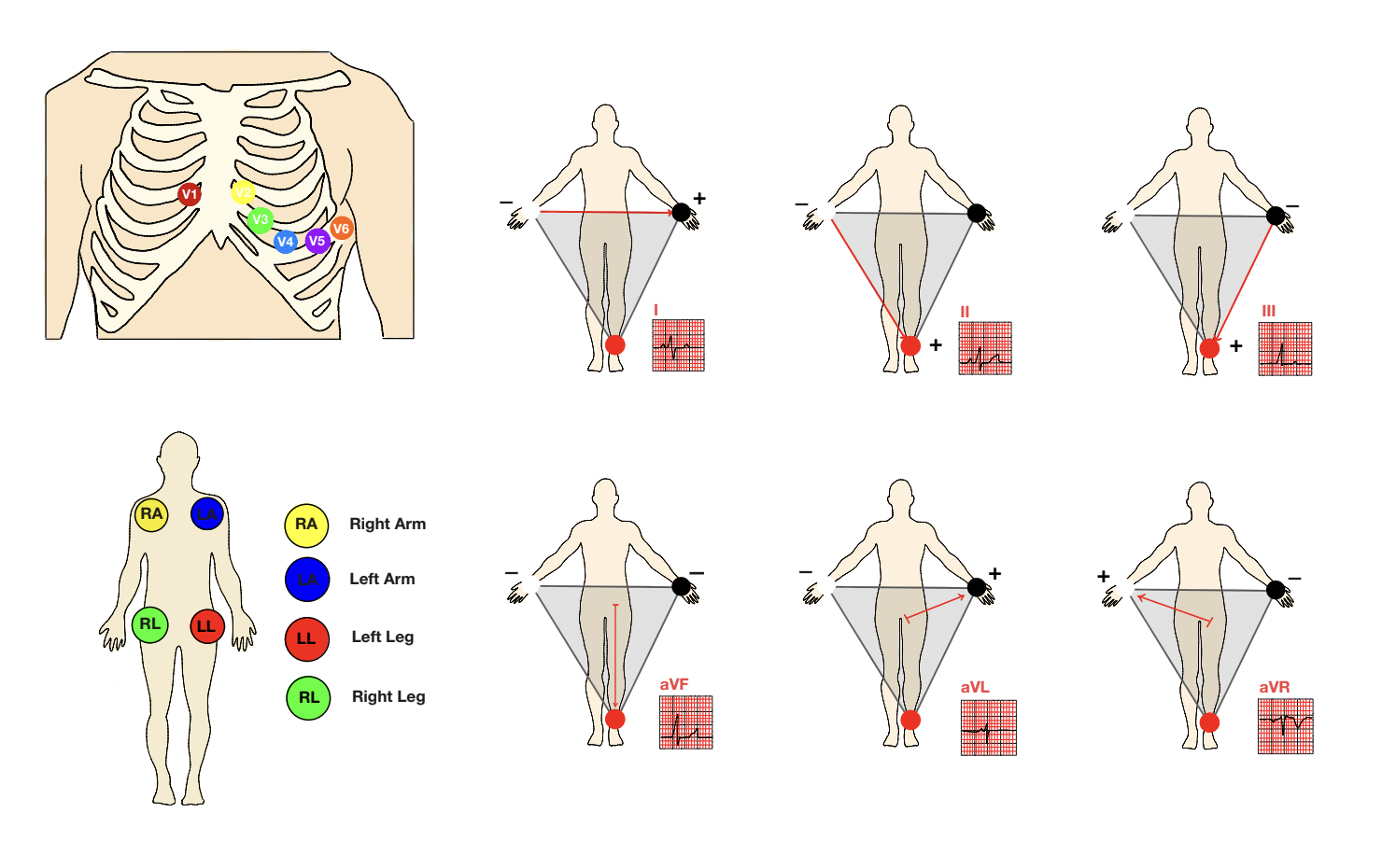 Clinical significance illustration
